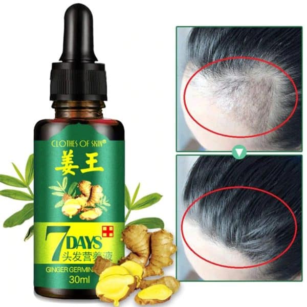 7 Day Hair Growth Ginger Oil