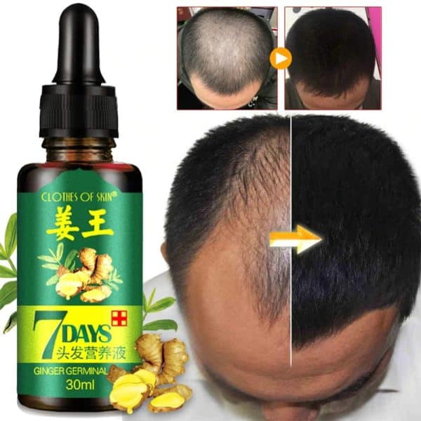 7 Day Hair Growth Ginger Oil