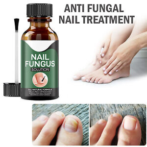 Foot Cure Nail Fungus Treatment