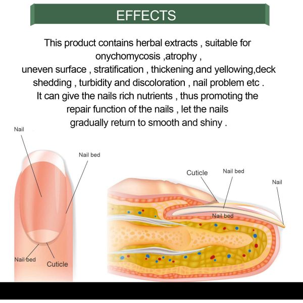Foot Cure Nail Fungus Treatment
