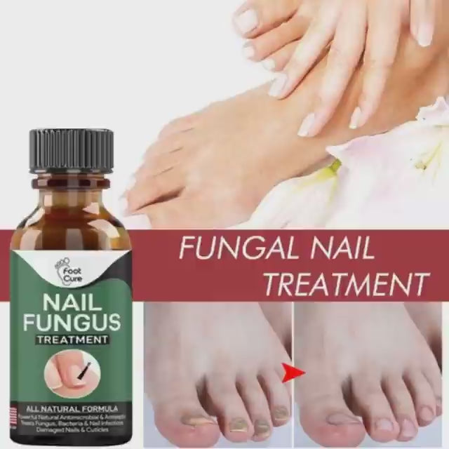 Foot Cure Nail Fungus Treatment
